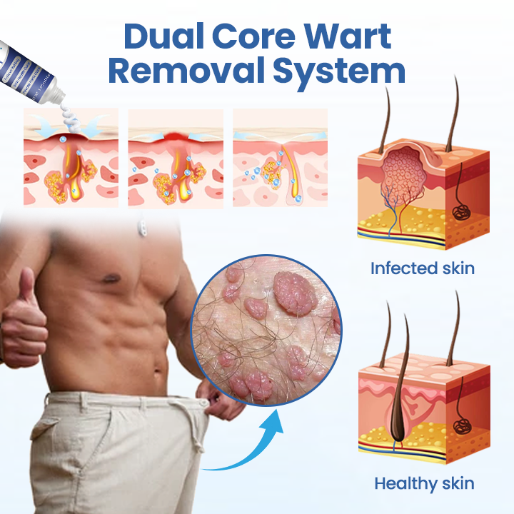 Thalvo® GentX WartRelief Cream