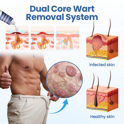 Thalvo® GentX WartRelief Cream