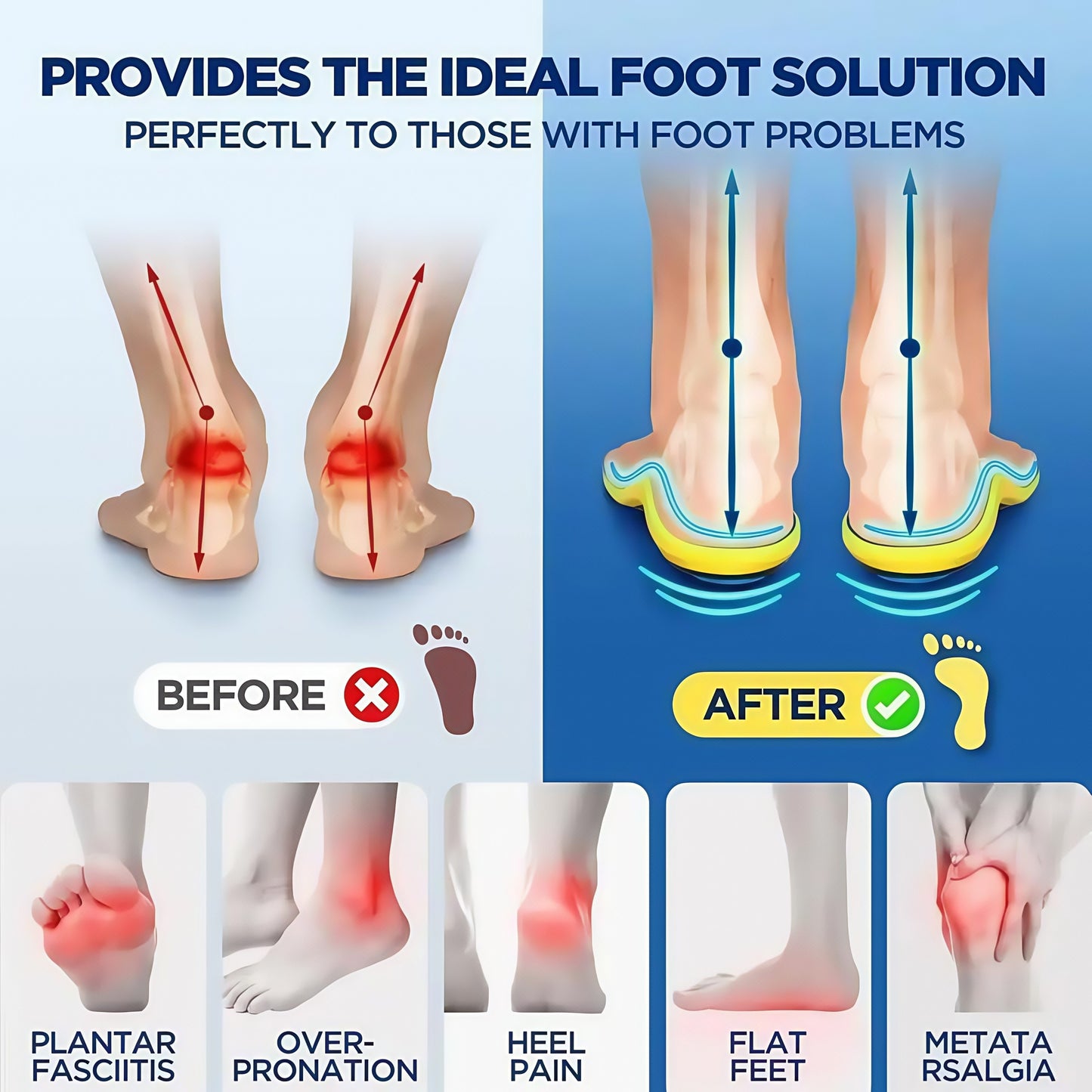 🔥LAST DAY 49% OFF🔥Plantar Fasciitis High Arch Shock Absorbing Insoles
