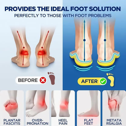 🔥LAST DAY 49% OFF🔥Plantar Fasciitis High Arch Shock Absorbing Insoles