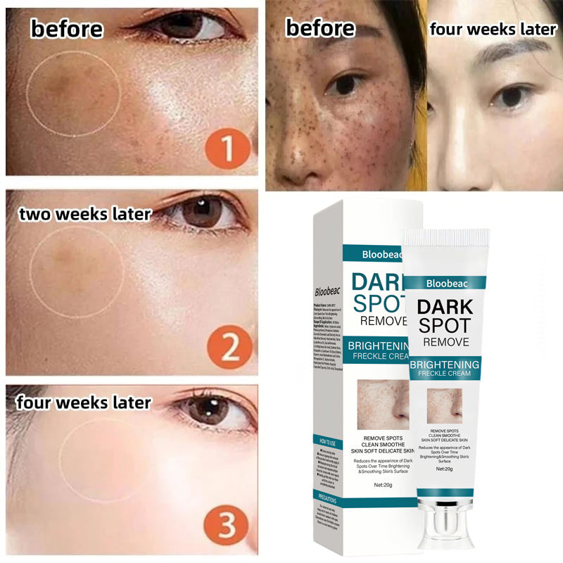 [Official Store] Thalvo® Advanced Blemish Correcting Cream – Clinically Proven to Fade Dark Spots, Freckles & Fine Lines