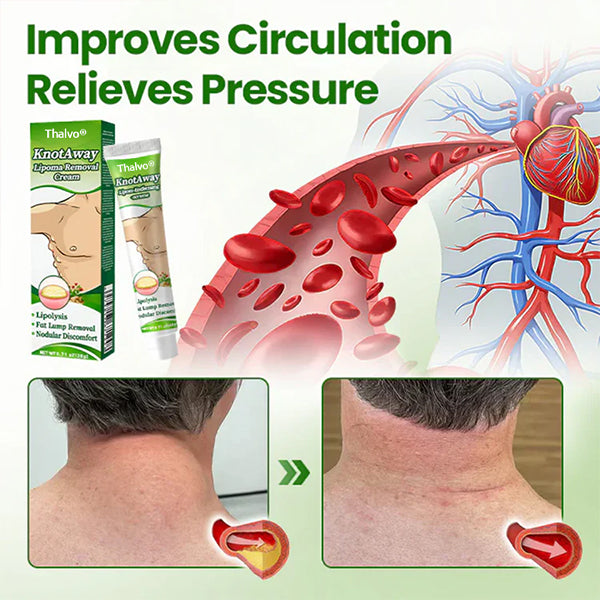 ⏰ FINAL HOURS! Get 60% OFF on Thalvo® Lipoma Dissolve Pro Cream — TODAY ONLY! 🔥