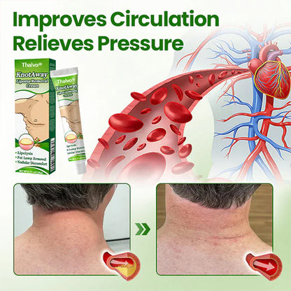 ⏰ FINAL HOURS! Get 60% OFF on Thalvo® Lipoma Dissolve Pro Cream — TODAY ONLY! 🔥