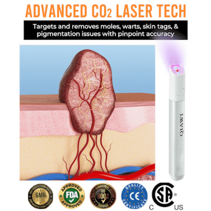 ✨Thalvo™ All-in-One CO₂ Laser Eraser Pen | Removes Moles, Warts, Skin Flaws & Pigmentation