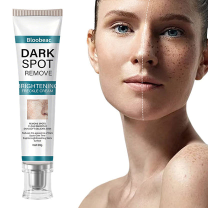 [Official Store] Thalvo® Advanced Blemish Correcting Cream – Clinically Proven to Fade Dark Spots, Freckles & Fine Lines