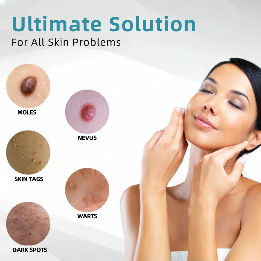 ✨Thalvo™ All-in-One CO₂ Laser Eraser Pen | Removes Moles, Warts, Skin Flaws & Pigmentation