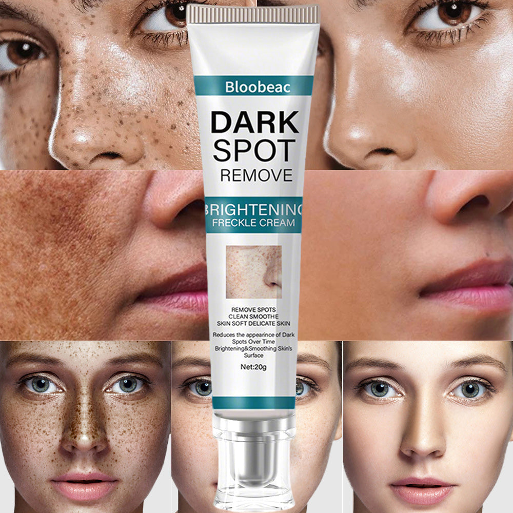 [Official Store] Thalvo® Advanced Blemish Correcting Cream – Clinically Proven to Fade Dark Spots, Freckles & Fine Lines