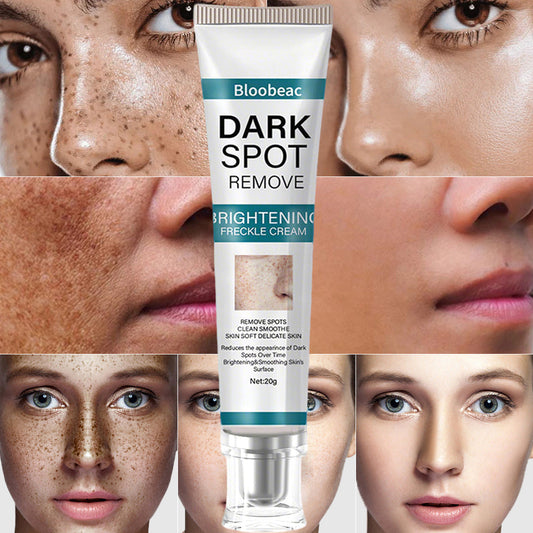 [Official Store] Thalvo® Advanced Blemish Correcting Cream – Clinically Proven to Fade Dark Spots, Freckles & Fine Lines