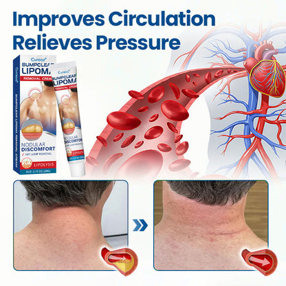 🎉SPECIAL OFFER: 60% OFF This Today Only!🔥Cvreoz® BumpClear Lipoma Removal Cream