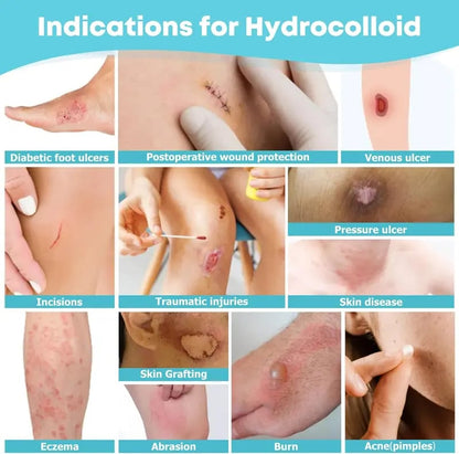 LIFARA Hydrocolloid Roll for Wound Care(2in*10ft, 19.7mil/ 0.5mm Thickness)