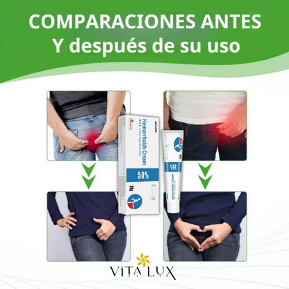 🔥Hot Sale 49% off🌟3 for 1 Herbal Hemorrhoid Cream | Relief from Pain, Itching, and Burning