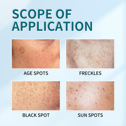 [Official Store] Thalvo® Advanced Blemish Correcting Cream – Clinically Proven to Fade Dark Spots, Freckles & Fine Lines