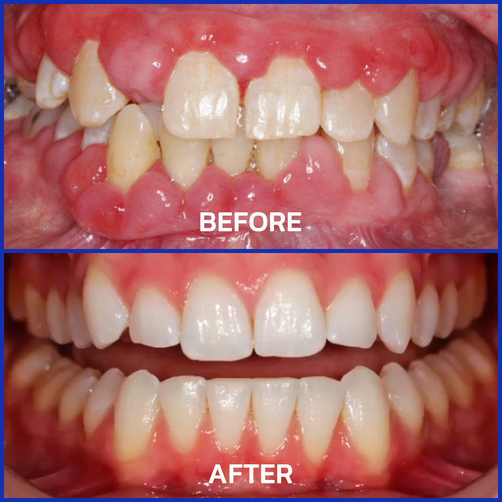 VioGloss Bee Venom Dental Therapy Oral Power
