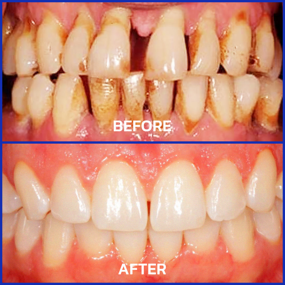 VioGloss Bee Venom Dental Therapy Oral Power