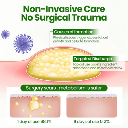 ⏰ FINAL HOURS! Get 60% OFF on Thalvo® Lipoma Dissolve Pro Cream — TODAY ONLY! 🔥