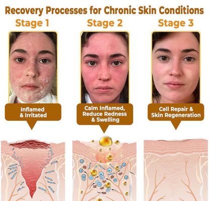 BeeVenom Cream | Finally Break Free From The Endless Cycle of Failed Creams, Harsh Steroids & Empty Promises