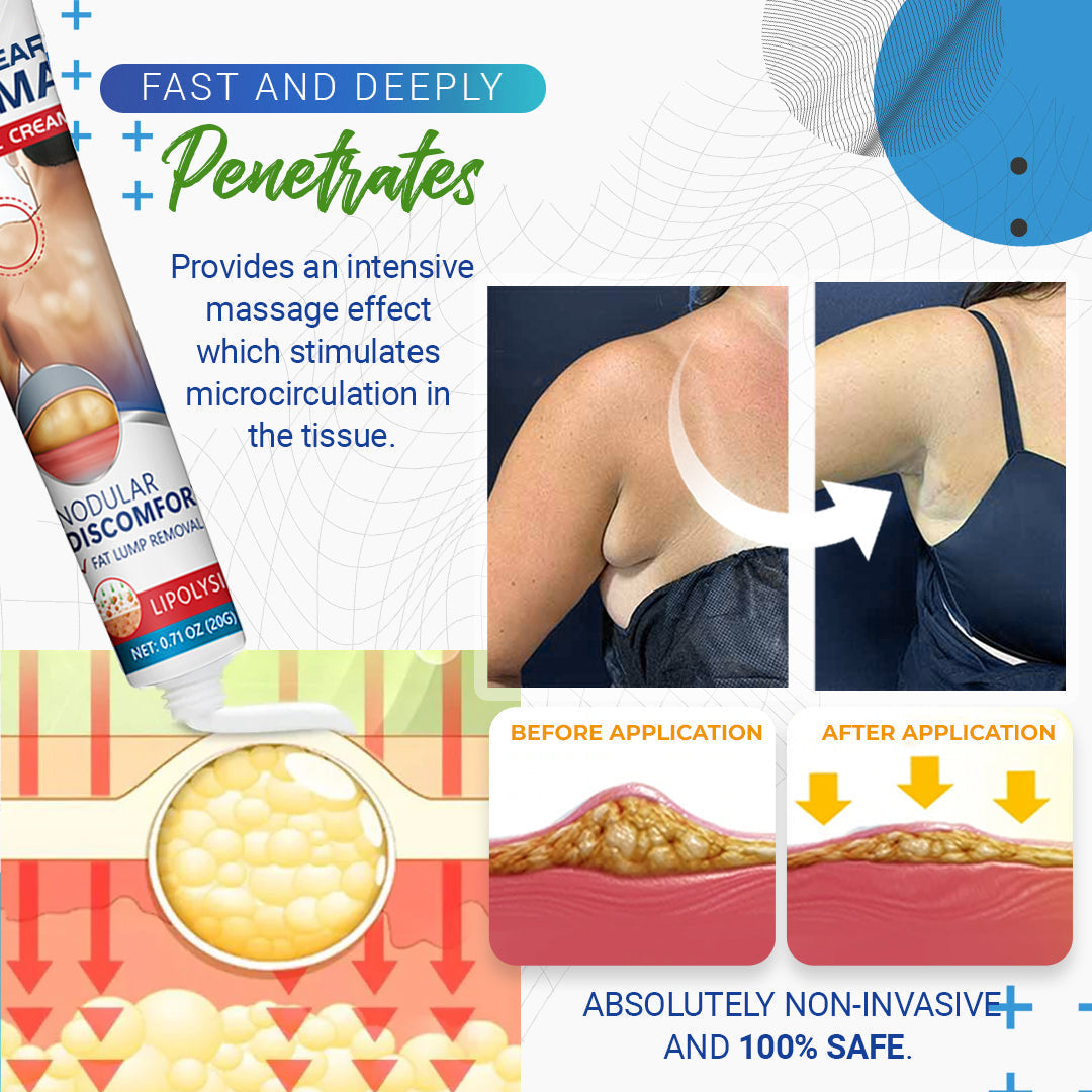 🎉SPECIAL OFFER: 60% OFF This Today Only!🔥Cvreoz® BumpClear Lipoma Removal Cream