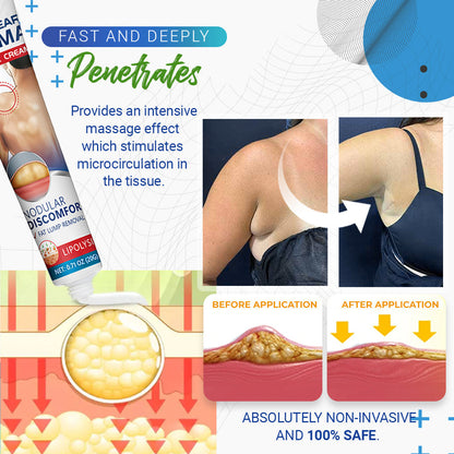 🎉SPECIAL OFFER: 60% OFF This Today Only!🔥Cvreoz® BumpClear Lipoma Removal Cream