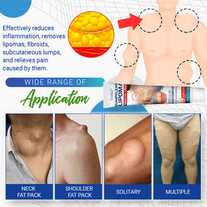 🎉SPECIAL OFFER: 60% OFF This Today Only!🔥Cvreoz® BumpClear Lipoma Removal Cream