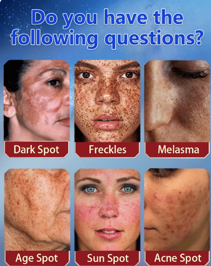 [Official Store] Thalvo® Advanced Blemish Correcting Cream – Clinically Proven to Fade Dark Spots, Freckles & Fine Lines