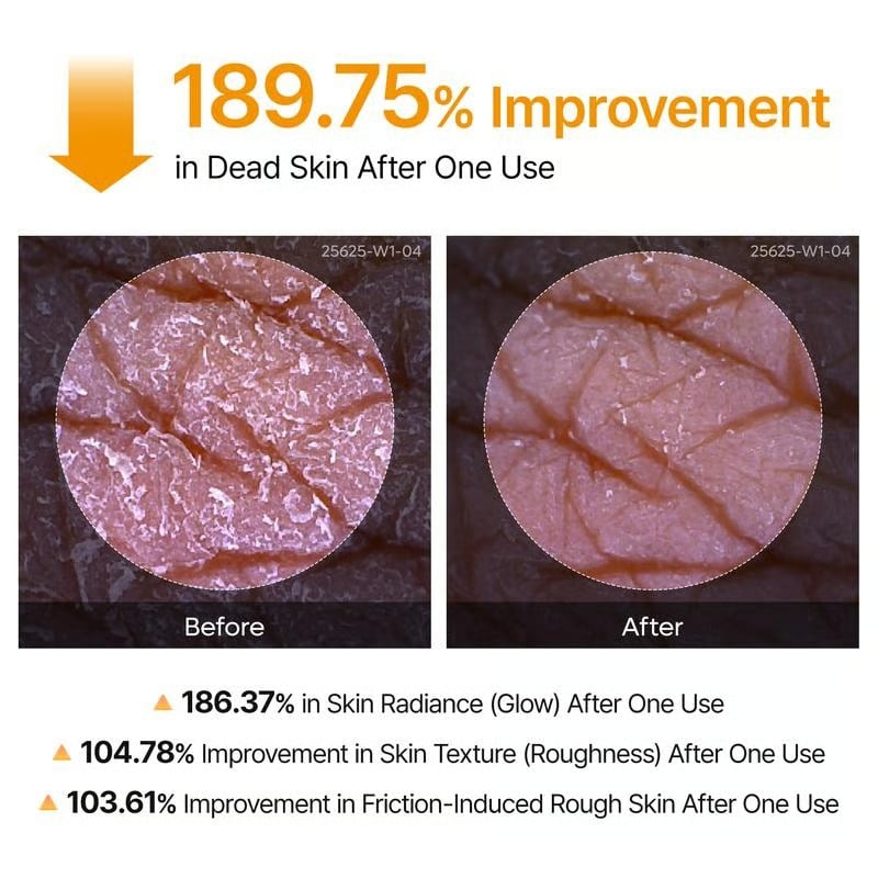 [Dr.melaxin Official]🌸 New! Peel Shot Keratin Care Kojic Acid Turmeric Spray