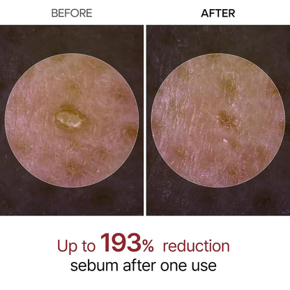 🔥Hot Sale 49% OFF🔥Rice Peel Glow Serum Ampoule